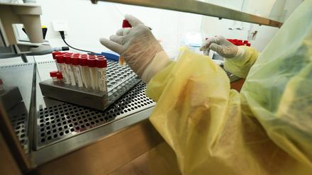 Für die Entdeckung seltener Erkrankungen ist oft Detektivarbeit im Labor nötig.