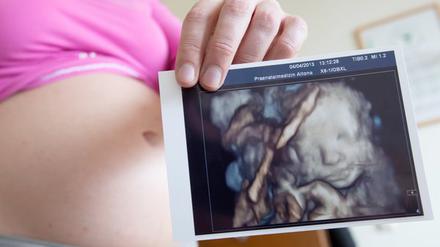Der test mit Ultraschall (Sonografie) kommt während der Schwangerschaft dreimal zum EInsatz. 
