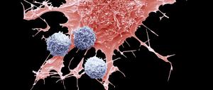 T-Zellen der Patienten können, gentechnisch aufgepeppt, wieder fit für den Kampf gegen Krebs gemacht werden. Blutkrebs können diese „CAR-T-Zellen“ heilen, in Zukunft vielleicht auch solide Tumore. 