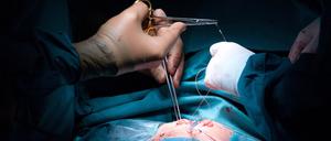 Die Operation am Herzen verlangt viel Fingerspitzengefühl, egal ob die OP bei offenem Brustkorb stattfindet oder per Katheter.