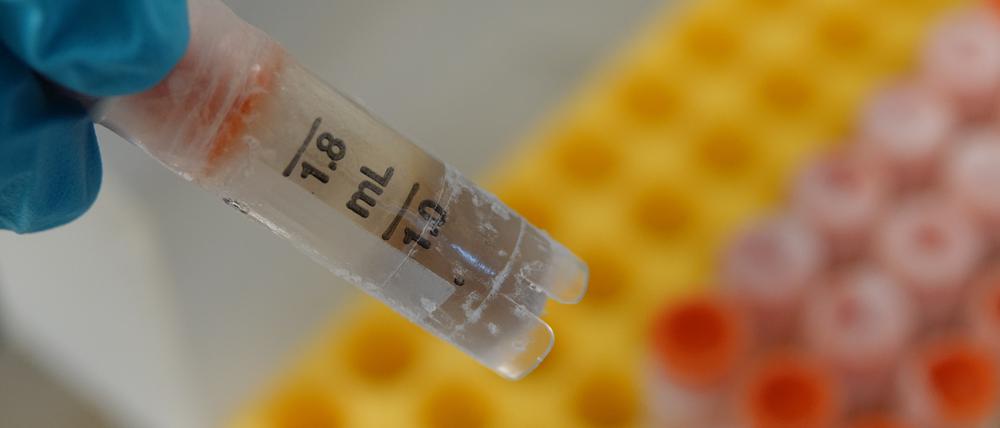 Eingefrorene Stuhlprobe in einem Gläschen – Schweizer Wissenschaftler wollen einen Tresor für Darmbakterien aus aller Welt anlegen.