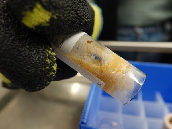 Eine eingefrorene Stuhlprobe in einem Gläschen. Schweizer Wissenschaftler wollen einen Tresor für Darmbakterien aus aller Welt anlegen.