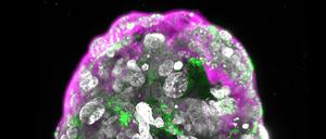 Im Labor gewachsen, aber vom menschlichen Original kaum zu unterscheiden: das „synthetische Embryomodell“ des Stammzellforschers Jacob Hanna.