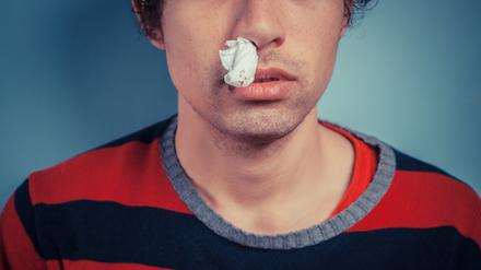 Nasenbluten tritt immer dann auf, wenn die feinen Gefäße in der gut durchbluteten Nasenschleimhaut verletzt werden. 