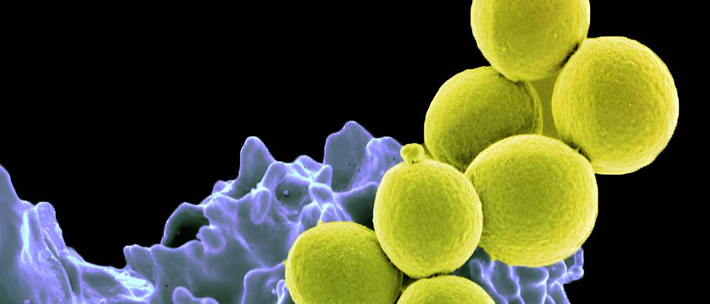 Multiresistente Bakterien, gelb eingefärbt, sind ein wachsendes Problem: Über zwei Millionen Menschen starben weltweit allein 2019 an Infektionen mit resistenten Erregern. 