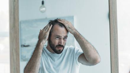 Unter Haarausfall leiden vor allem Männer – eine Haartransplantation schafft Abhilfe.