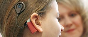 Ein Mädchen mit Cochlea-Implantat. Solche Geräte wandeln Schall in elektrische Impulse um, durch die der Hörnerv in der Hörschnecke stimuliert wird.