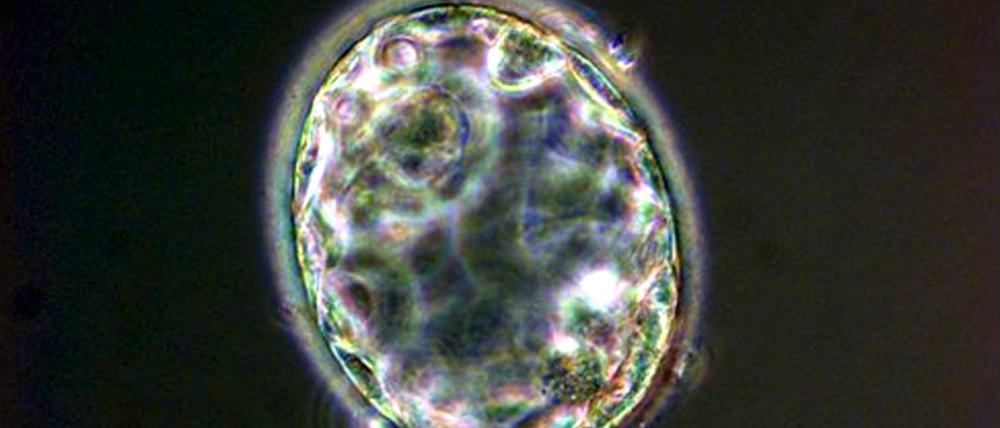 This is five day old cloned human embryo- the blastocyst, five days after nuclear transfer took place - which was created at the Centre for Life in the north England city of Newcastle by scientists Dr. Miodrag Stojkovic and Prof. Alison Murdoch and announced by them Thursday, 19 May 2005. It is the first to be created in Britain and the first to be grown in the western world. The team in Newcastle created three human clones, the most advanced being a three day old embryo the size of a full stop. The announcement came as a south Korean team also disclosed a significant cloning milestone. EPA/RBM ONLINE +++(c) dpa - Bildfunk+++ |