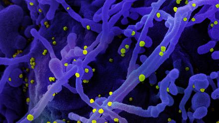 Sars-CoV-2-Viruspartikel (gelb) werden von einer infizierten Zelle (blau) abgeschnürt und befallen neue Zellen.