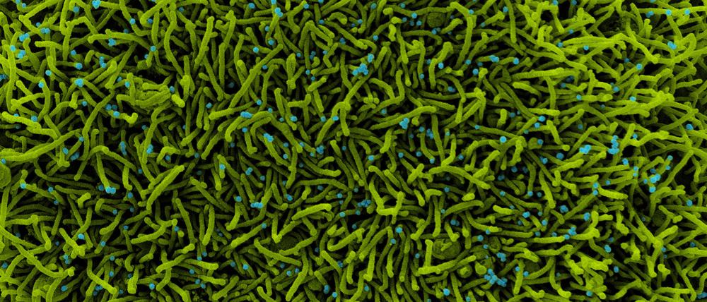 Neue Viruspartikel (blau) schnüren sich von der Oberfläche einer infizierten Zelle (grün) ab.
