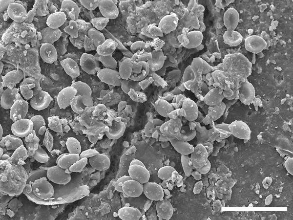 Auch Pilze wachsen auf Mikroplastik-Partikeln. Auf elektronenmikroskopischen Bildern der Universität Bayreuth ist zu erkennen, wie Pilzsporen entlang eines Risses in einem Mikroplastik-Partikel wachsen.