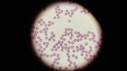 Mikroskopaufnahme von Babesien, mit denen sich Hunde durch einen Zeckenbiss infizieren können.