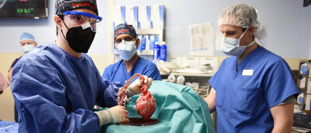 Der Arzt Bartley Griffith hält das Herz eines gentechnisch verädnerten Schweins, kurz bevor er es dem Herzpatienten David Bennett einsetzt. 