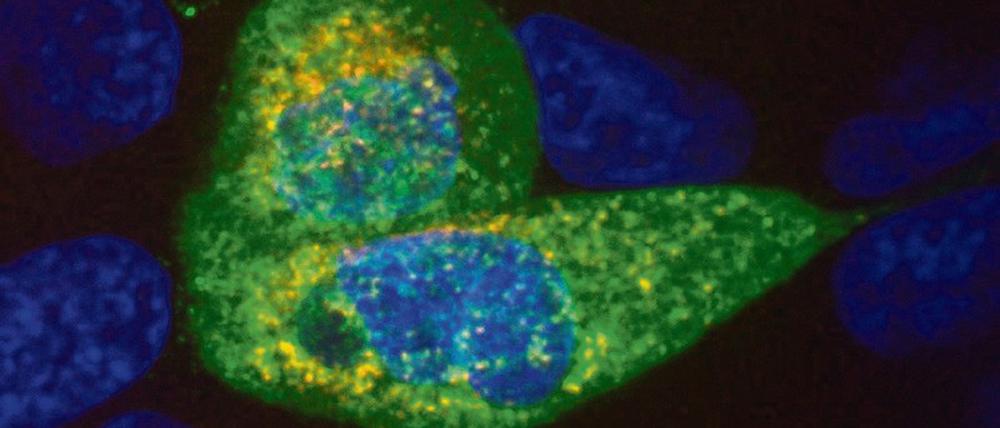 Gemengelage. In Lungenzellen, die mit Sars-CoV-2 (grün) infiziert sind, kann sich so viel Virus-RNA (rot) ansammeln, dass einige Bruchstücke offenbar in bestimmten Fällen in das menschliche Erbgut (blau) eindringen können.  
