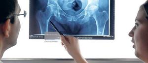 Röntgenärzte stellen anhand von Bildmaterial Krankheiten und Verletzungen fest. Umstritten ist, ob Ferndiagnosen Radiologen vor Ort ersetzen können.