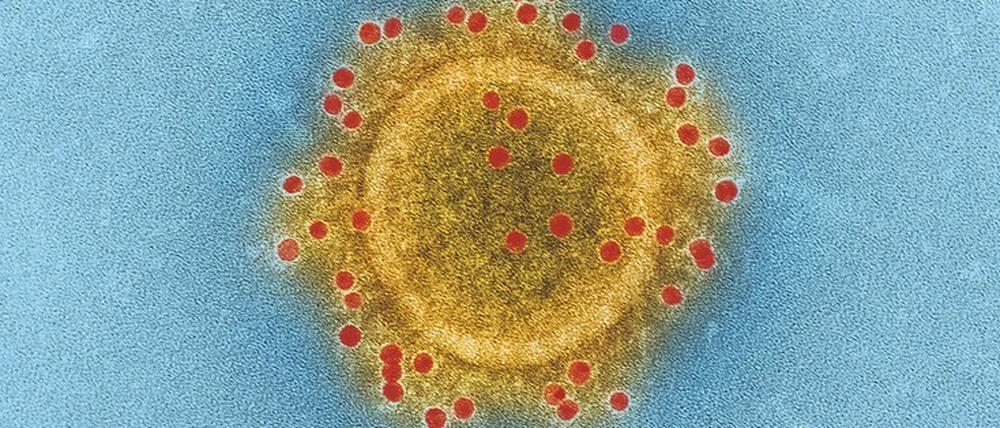 Oberflächlichkeiten. Strukturen außen am Virus (hier MERS, ein dem derzeit problematischen Virus sehr ähnliches) sind entscheidend für die Infektiosität.  
