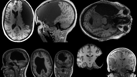 Gehirnscans aus dem „Interesting brains“-Projekt am MIT. 