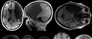 Gehirnscans aus dem „Interesting brains“-Projekt am MIT. 