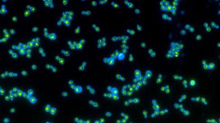 Gentechnisch mit grünem Rhodopsin ausgestattete Hefezellen, die sich auch von Licht ernähren können. 