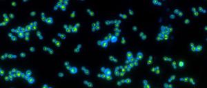 Gentechnisch mit grünem Rhodopsin ausgestattete Hefezellen, die sich auch von Licht ernähren können. 