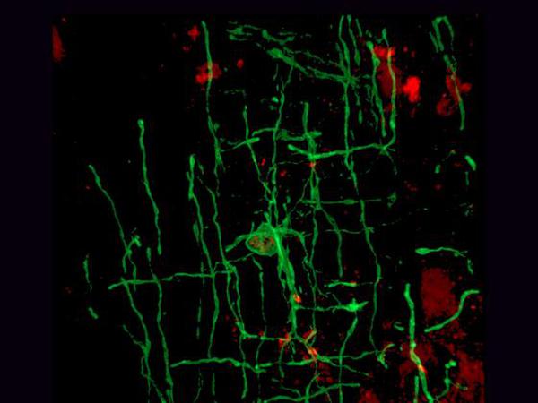 Myelinisierte (grün) Nervenzellen.