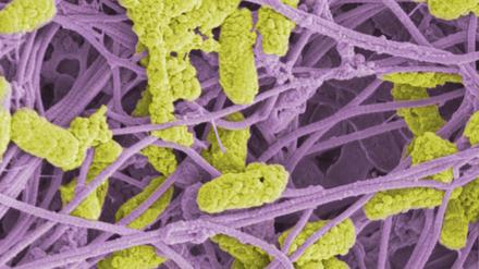 Haben sich Bakterien (gelb) ins Bindegewebe (lila) der Haut  eingenistet, können sie die Heilung von Wunden stören.