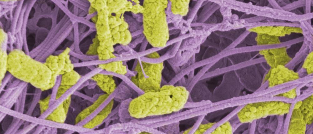 Haben sich Bakterien (gelb) ins Bindegewebe (lila) der Haut  eingenistet, können sie die Heilung von Wunden stören.