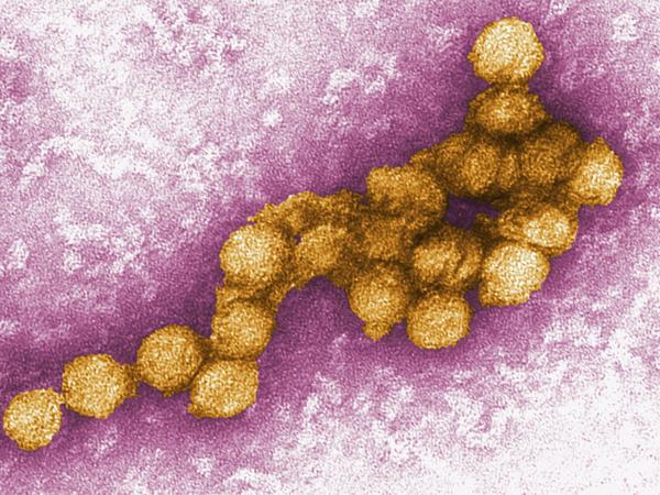 Das West-Nil-Virus unter dem Elektronenmikroskop. 